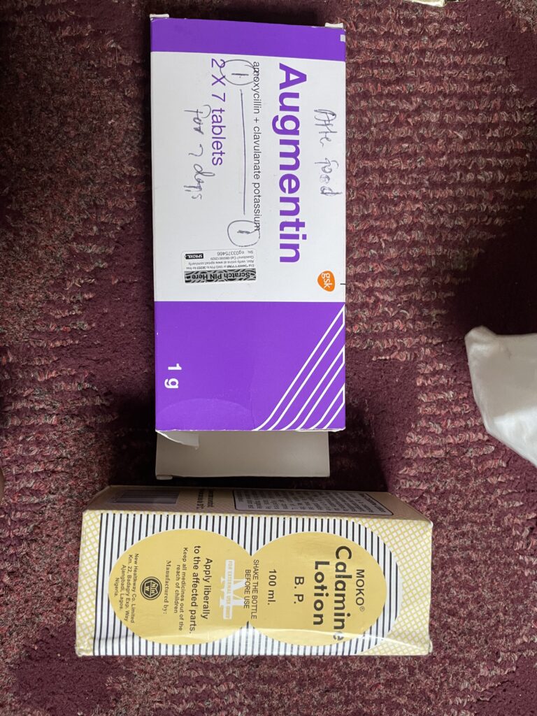 Two medicine boxes. Augmentin in a small white and purple box and Calamine lotion in a small yellow box with black and white stripes.